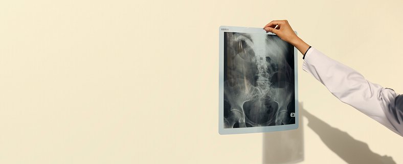 Critical Illness Insurance / Takaful